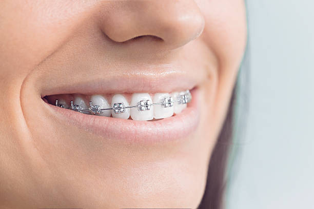 Why Choose Us for Your Dental Needs in Greenhills, OH